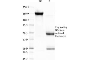 SDS-PAGE Analysis Purified CELA3B Monoclonal Antibody (CELA3B/1757). (Elastase 3B 抗体  (AA 82-238))