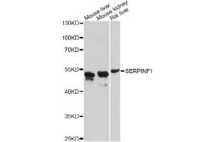 Western blot analysis of extracts of various cell lines, using SERPINF1 antibody (ABIN4905126) at 1:3000 dilution. (PEDF 抗体)