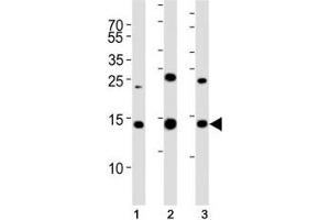 Western blot analysis of lysate from (1) 293T, (2) HL-60, (3) Jurkat cell line using SUMO2 antibody. (SUMO2 抗体  (AA 63-93))