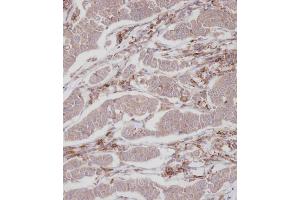 Immunohistochemical analysis of A on paraffin-embedded Human breast carcinoma tissue. (ENOX2 抗体  (N-Term))