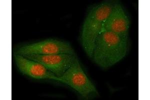 IF analysis of c-Myc using anti-c-Myc antibody (ABIN3043598) and anti-Beta Tubulin antibody (ABIN7602743). (c-MYC 抗体  (AA 257-439))