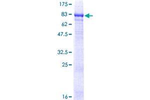 Image no. 1 for Phosphatidylinositol 4-Kinase, Catalytic, alpha Pseudogene 2 (PI4KAP2) (AA 1-577) protein (GST tag) (ABIN1314979) (PI4KAP2 Protein (AA 1-577) (GST tag))