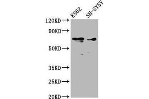 Western Blot Positive WB detected in: K562 whole cell lysate, SH-SY5Y whole cell lysate All lanes: ALOX12 antibody at 3. (ALOX12 抗体  (AA 508-658))