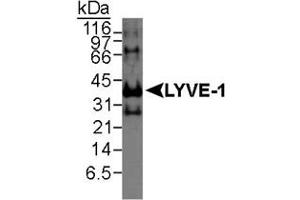 Western blot analysis of LYVE1 in recombinant human protein using LYVE1 polyclonal antibody . (LYVE1 抗体  (AA 250-322))