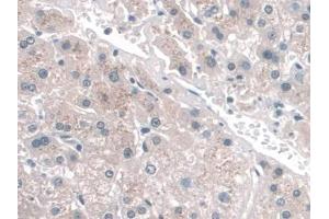 Detection of CD34 in Human Liver Tissue using Monoclonal Antibody to Cluster Of Differentiation 34 (CD34)