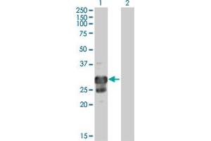 Western Blot analysis of TPPP expression in transfected 293T cell line by TPPP MaxPab polyclonal antibody. (Tppp 抗体  (AA 1-219))