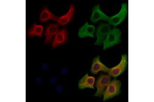 ABIN6261583 and ABIN6272916 staining Hela cells by IF/ICC. (ERAL1 抗体  (Internal Region))