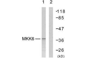 Western blot analysis of extract from MDA-MB-435 cells, using MKK6 (Ab-207) antibody (E021153).