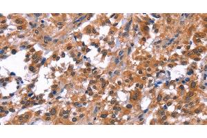 Immunohistochemistry (Paraffin-embedded Sections) (IHC (p)) image for anti-Phosphatidylinositol-4-Phosphate 5-Kinase, Type I, beta (PIP5K1B) antibody (ABIN7236220)