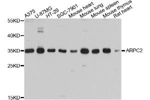 Western blot analysis of extracts of various cell lines, using ARPC2 antibody (ABIN4902949) at 1:1000 dilution. (ARPC2 抗体)