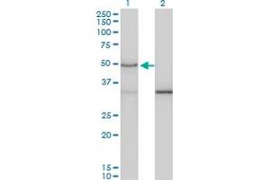Western Blot analysis of SMAD3 expression in transfected 293T cell line by SMAD3 monoclonal antibody (M02), clone 7F3. (SMAD3 抗体  (AA 120-221))