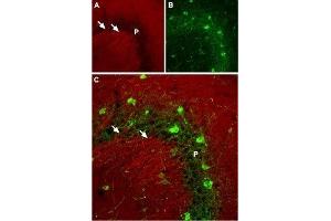 Immunohistochemistry (IHC) image for anti-Sodium Channel, Voltage-Gated, Type II, alpha Subunit (SCN2A) (AA 467-485), (Intracellular) antibody (ABIN7043641)