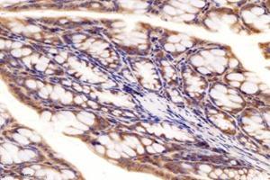Immunohistochemistry analysis of paraffin-embedded mouse colon using,RRAGB (ABIN7075379) at dilution of 1: 4000 (RRAGB 抗体)