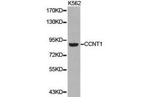 Western Blotting (WB) image for anti-Cyclin T1 (CCNT1) antibody (ABIN1871567) (Cyclin T1 抗体)