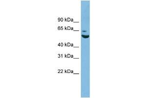 WB Suggested Anti-ZNF563 Antibody Titration: 0. (ZNF563 抗体  (N-Term))