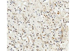 IHC analysis of RRP4/EXOSC2 using anti-RRP4/EXOSC2 antibody (ABIN7602188). (EXOSC2 抗体  (AA 62-293))