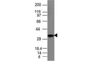 Western blot analysis of Raji cell lysate using CLIP antibody (CLIP/1133) (CLIP 抗体)