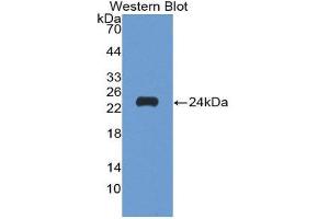 Western Blotting (WB) image for anti-Matrix Metallopeptidase 9 (Gelatinase B, 92kDa Gelatinase, 92kDa Type IV Collagenase) (MMP9) (AA 213-399) antibody (ABIN3201434) (MMP 9 抗体  (AA 213-399))
