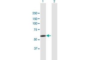 Western Blot analysis of LYN expression in transfected 293T cell line by LYN MaxPab polyclonal antibody. (LYN 抗体  (AA 1-512))