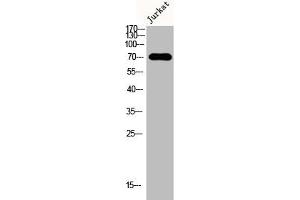 Western Blot analysis of Jurkat cells using DMPK Polyclonal Antibody (DMPK 抗体  (N-Term))