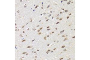 Immunohistochemistry of paraffin-embedded rat brain using BAZ1B antibody. (BAZ1B 抗体)