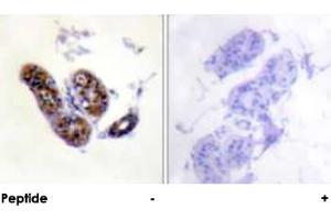 Immunohistochemical analysis of paraffin-embedded human skin tissue using MITF polyclonal antibody . (MITF 抗体  (Ser73, Ser180))