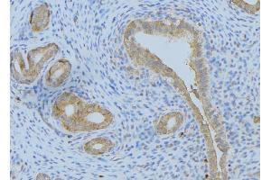 ABIN6275102 at 1/100 staining Human uterus tissue by IHC-P. (FBLN4 抗体  (Internal Region))