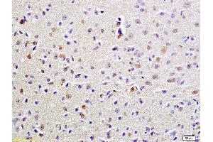 Formalin-fixed and paraffin embedded rat brain labeled with Anti-FUS Polyclonal Antibody, Unconjugated (ABIN682438) at 1:200 followed by conjugation to the secondary antibody and DAB staining (FUS 抗体  (AA 421-526))