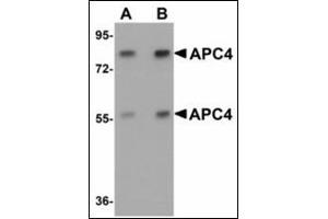 Western blot analysis of APC4 in mouse liver tissue lysate with APC4 antibody at (A) 1 and (B) 2 µg/ml. (ANAPC4 抗体  (N-Term))