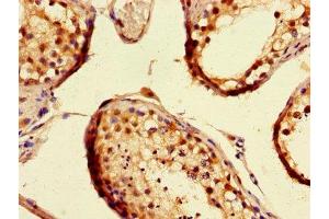 Immunohistochemistry of paraffin-embedded human testis tissue using ABIN7160045 at dilution of 1:100 (ASK1 抗体  (AA 363-431))