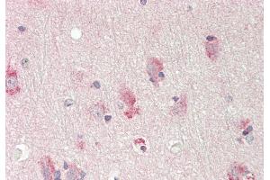 Rabbit Anti-ST6GALNAC1 antibody  Formalin Fixed Paraffin Embedded Tissue: Human Brain, Cortex Primary antibody Concentration: 1:100 Secondary Antibody: Donkey anti-Rabbit-Cy3 Secondary Antibody Concentration: 1:200 Magnification: 20x Exposure Time: 0. (ST6GALNAC1 抗体  (Middle Region))