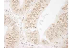 Immunohistochemistry (IHC) image for anti-Bromodomain PHD Finger Transcription Factor (BPTF) (AA 1350-1400) antibody (ABIN7448561) (BPTF 抗体  (AA 1350-1400))