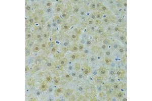 Immunohistochemistry of paraffin-embedded rat liver using SOX14 antibody (ABIN6292418) at dilution of 1:100 (40x lens). (SOX14 抗体)