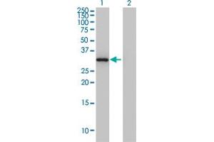 Western Blot analysis of ANXA3 expression in transfected 293T cell line by ANXA3 monoclonal antibody (M12), clone 4F1. (Annexin A3 抗体  (AA 1-323))