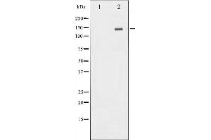 Western blot analysis of Met expression in HepG2 whole cell lysates,The lane on the left is treated with the antigen-specific peptide. (c-MET 抗体  (C-Term))