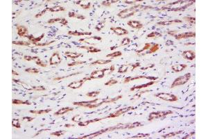 Formalin-fixed and paraffin embedded human kidney labeled with Anti-PRAM1 Polyclonal Antibody, Unconjugated  at 1:200 followed by conjugation to the secondary antibody and DAB staining. (PRAM1 抗体  (AA 551-650))