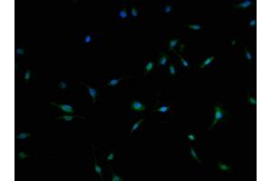 Immunofluorescence staining of U251 cells with ABIN7174848 at 1:100, counter-stained with DAPI. (C3orf38 抗体  (AA 80-329))