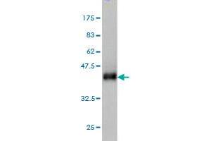 Western Blotting (WB) image for anti-Carnitine O-Octanoyltransferase (CROT) (AA 2-99) antibody (ABIN565763)