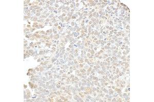anti-hSET1 (AA 1200-1250) antibody