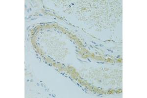 Immunohistochemistry of paraffin-embedded rat ovary using IFT57 antibody (ABIN6292987) at dilution of 1:100 (40x lens). (IFT57 抗体)