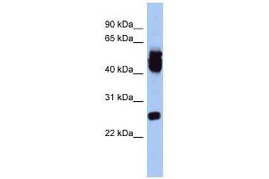 ERAS antibody used at 1 ug/ml to detect target protein. (ERAS 抗体  (Middle Region))