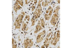 Immunohistochemistry (IHC) image for anti-Glutathione S-Transferase theta 1 (GSTT1) (AA 1-240) antibody (ABIN3021871)