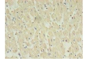 Immunohistochemistry of paraffin-embedded human heart tissue using ABIN7170733 at dilution of 1:100 (STRADB 抗体  (AA 212-418))