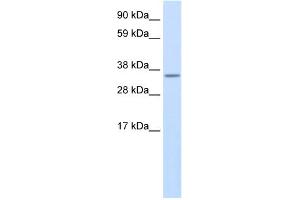 WB Suggested Anti-Use1 Antibody Titration:  0. (UBE2Z 抗体  (N-Term))