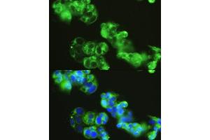 Immunofluorescence analysis of HepG2 cells using GOLG antibody (4688) at dilution of 1:150. (GOLGA1 抗体  (AA 1-300))