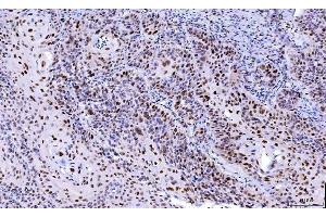 IHC analysis of Cdk2 using anti-Cdk2 antibody (ABIN7602522).