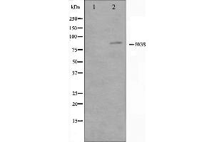 Western blot analysis on HepG2 cell lysate using HGS Antibody. (HGS 抗体  (Internal Region))