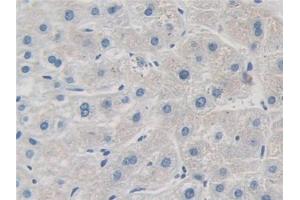 DAB staining on IHC-P; Samples: Human Liver Tissue (GRK4 抗体  (AA 187-449))