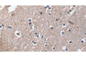 Immunohistochemistry of paraffin-embedded Human brain using DUT Polyclonal Antibody at dilution of 1:30 (Deoxyuridine Triphosphatase (DUT) 抗体)