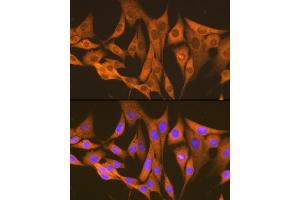 Immunofluorescence analysis of NIH-3T3 cells using  Rabbit mAb (ABIN7265669) at dilution of 1:100 (40x lens). (ASS1 抗体)